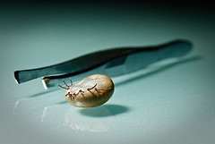 A large tick wriggling upside-down next to a pair of tweezers