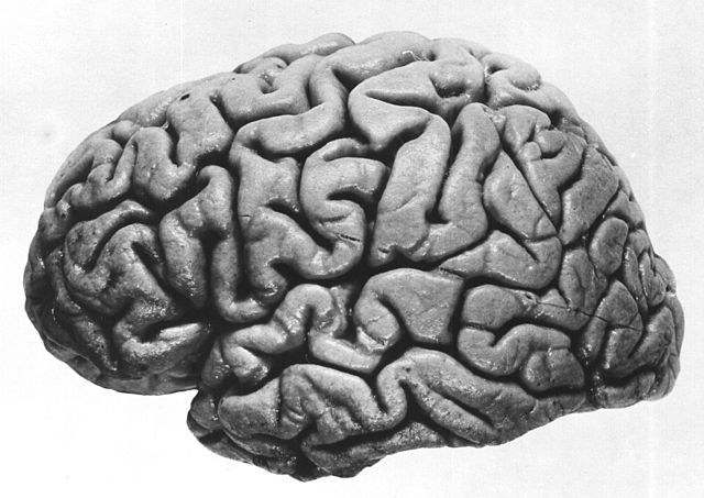 Photo of human brain